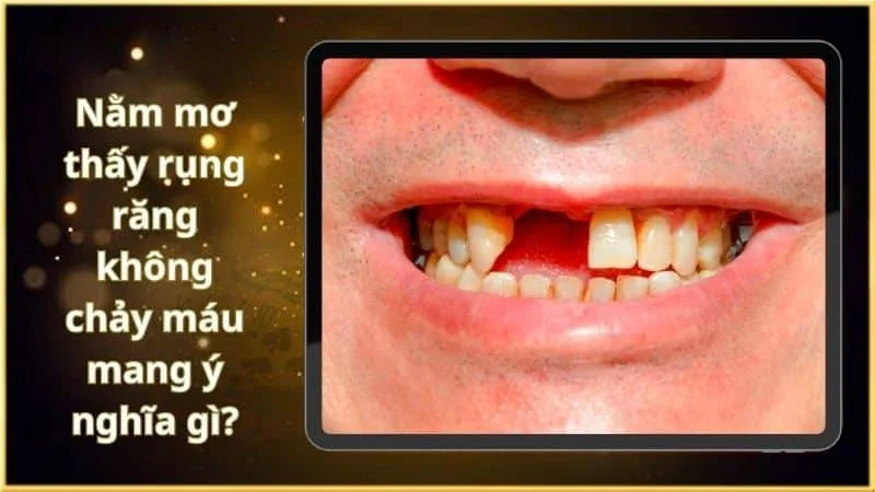 y-nghia-chung-cua-chiem-bao-rung-rang-nhung-khong-chay-mau
